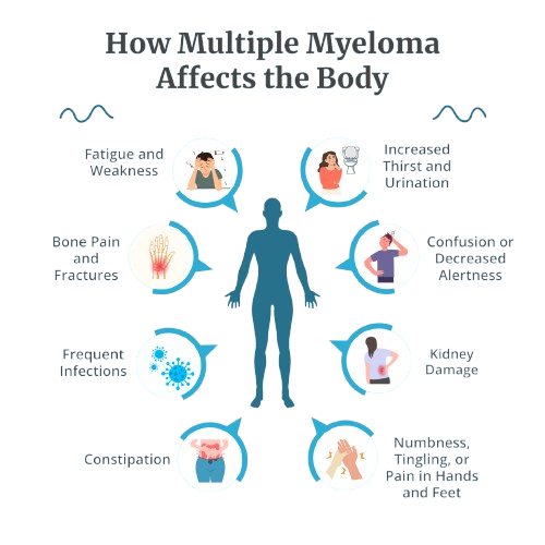 how multiple myeloma affect the body