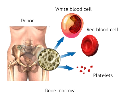 bone marrow transplant donor