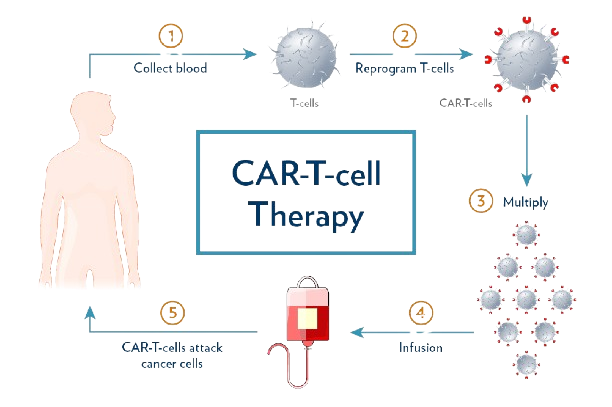 car t cell process