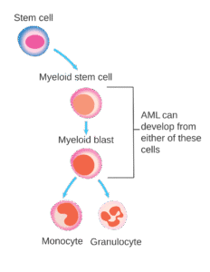 acute myeloid leukemia