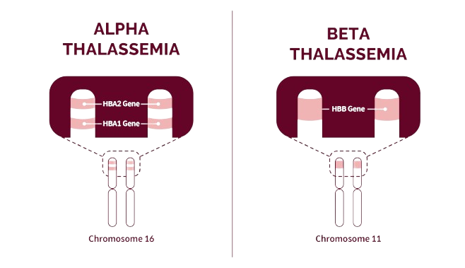 types of thalassemia