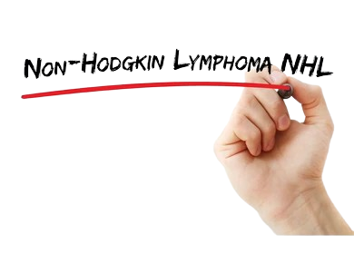 non- hodgkin lymphoma