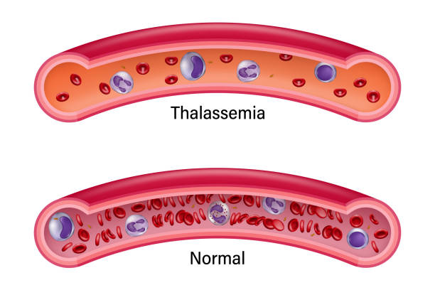 normal cell and thalassemia cell
