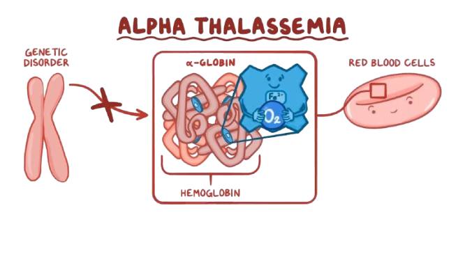 alpha thalassemia