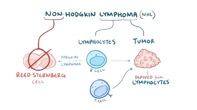 Non-Hodgkin’s Lymphoma