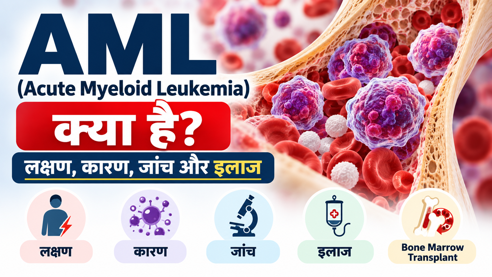 AML (Acute Myeloid Leukemia) क्या है? लक्षण, कारण, जांच और इलाज